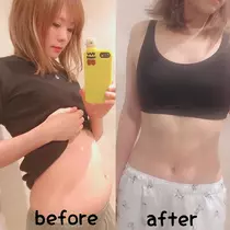 PON