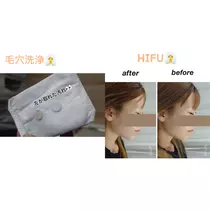 むつみ