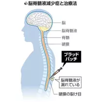 紫音