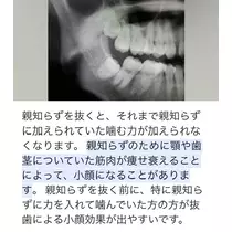 あこ