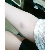 ひな