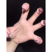 マコト