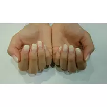 らん