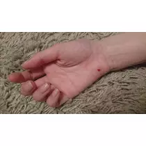 らん