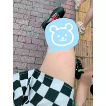 あこ