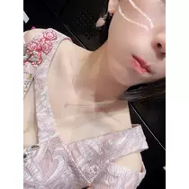 ウミ