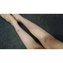 らん