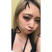 ナツ