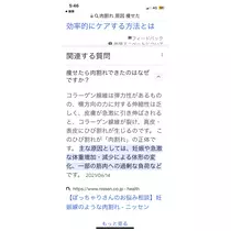 あみ