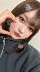 紫外線は私の敵