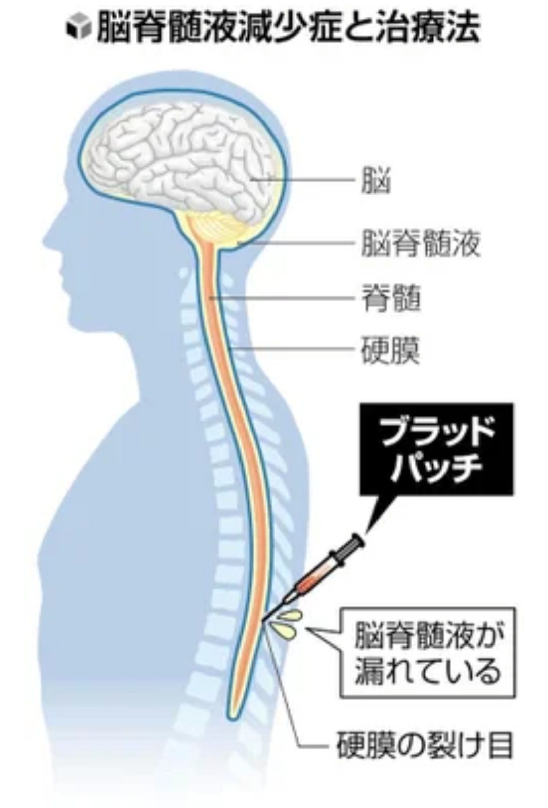 紫音