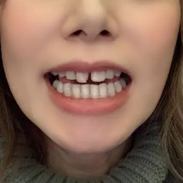如月 凛