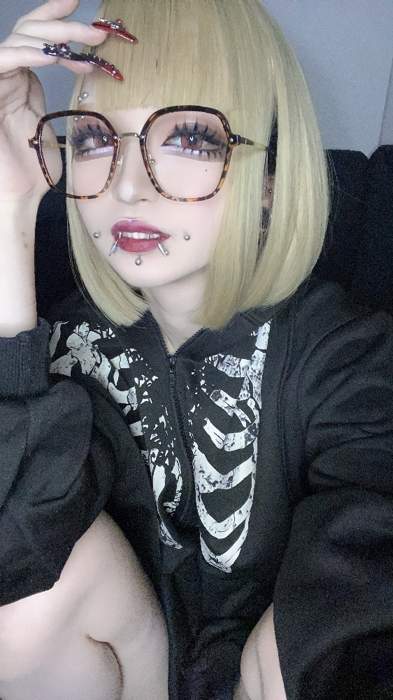 える