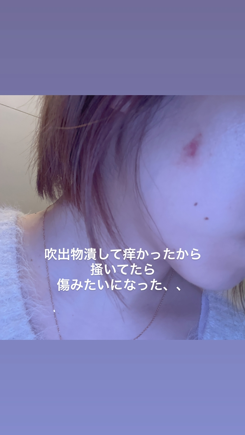 水城 百合